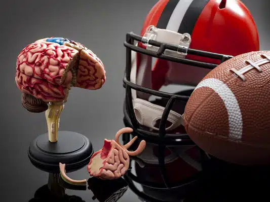 NFL Concussion Claims